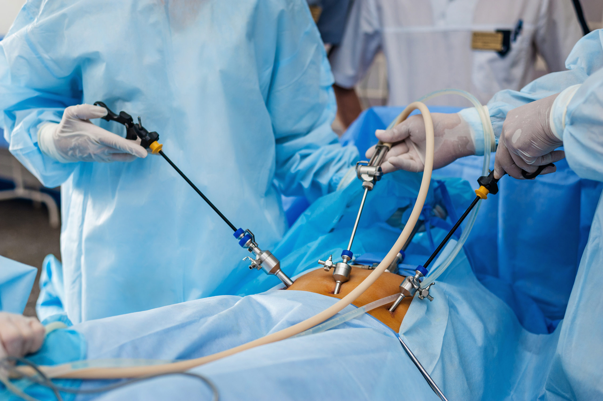 Operation using endoscopic equipment