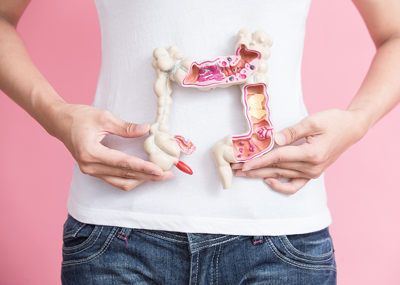 woman with colorectal cancer